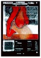 /album/hracie-pole/serigrafia-tipos-akty-xy-5-jpg/